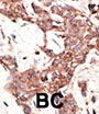 AP20658c AKT1/2/3 Antibody (Center)